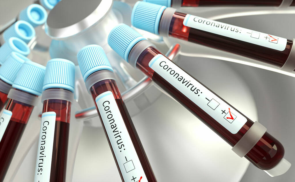 Test sierologici sui donatori di sangue